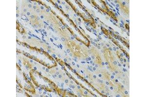 Immunohistochemistry of paraffin-embedded Mouse kidney using COG2 Polyclonal Antibody at dilution of 1:100 (40x lens). (COG2 抗体)