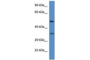 Image no. 1 for anti-Peroxisomal Biogenesis Factor 2 (PEX2) (N-Term) antibody (ABIN6746208) (PEX2 抗体  (N-Term))