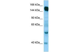 WB Suggested Anti-RAPGEF6 Antibody Titration: 1. (RAPGEF6 抗体  (N-Term))