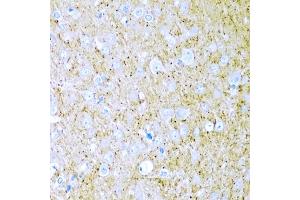 Immunohistochemistry of paraffin-embedded rat brain using WNT2 antibody (ABIN6130801, ABIN6150239, ABIN6150241 and ABIN6221571) at dilution of 1:200 (40x lens). (WNT2 抗体  (AA 26-360))