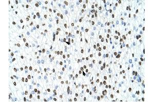 HNRPA1 antibody was used for immunohistochemistry at a concentration of 4-8 ug/ml to stain Myocardial cells (arrows) in Human Head.
