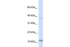 WB Suggested Anti-NHLH1 Antibody Titration:  0. (NHLH1 抗体  (N-Term))