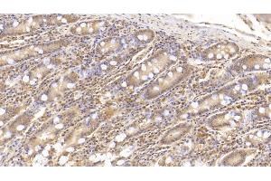 Detection of IL6 in Human Small intestine Tissue using Monoclonal Antibody to Interleukin 6 (IL6) (IL-6 抗体  (AA 30-212))