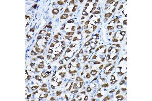 Immunohistochemistry of paraffin-embedded rat stomach using PGLS Rabbit pAb (ABIN6131432, ABIN6145509, ABIN6145510 and ABIN6224398) at dilution of 1:200 (40x lens). (PGLS 抗体  (AA 1-258))