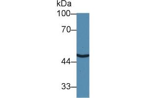 Western blot analysis of Human HeLa cell lysate, using Human SLC30A8 Antibody (3 µg/ml) and HRP-conjugated Goat Anti-Rabbit antibody ( (SLC30A8 抗体  (AA 1-80))