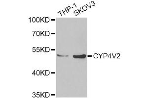 Western blot analysis of extracts of various cell lines, using CYP4V2 Antibody (ABIN2562110) at 1:1000 dilution. (CYP4V2 抗体)
