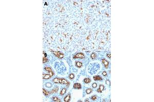 Immunohistochemical staining (Formalin-fixed paraffin-embedded sections) of human pancreas (A) and mouse kidney (B) with CFTR monoclonal antibody, clone CFTR/1342 . (CFTR 抗体)