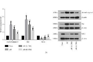 Effect of rTMS on apoptosis and viability of neurons in hippocampus regions of AD mice. (beta Actin 抗体  (AA 1-25))