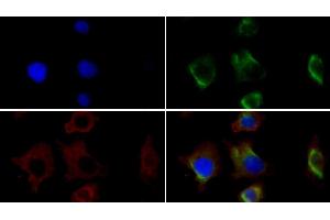 Detection of VIM in Human HepG2 cell using Monoclonal Antibody to Vimentin (VIM) (Vimentin 抗体)