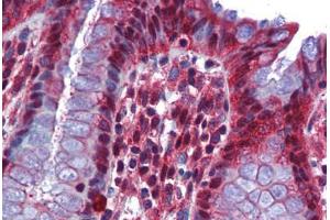 Human Colon: Formalin-Fixed, Paraffin-Embedded (FFPE) (RBM47 抗体  (AA 287-336))