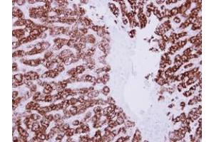 Image no. 1 for anti-Aldehyde Dehydrogenase 6 Family, Member A1 (ALDH6A1) (AA 1-255) antibody (ABIN1496604) (ALDH6A1 抗体  (AA 1-255))
