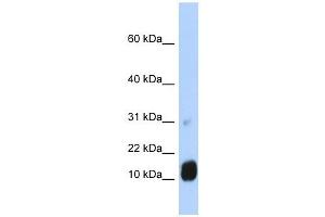 GCHFR antibody used at 1 ug/ml to detect target protein. (GCHFR 抗体  (N-Term))