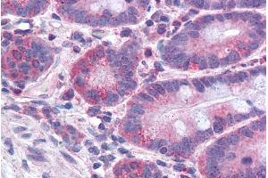 Immunohistochemistry (IHC) image for anti-Acyl-CoA Synthetase Long-Chain Family Member 4 (ACSL4) (C-Term) antibody (ABIN184846)