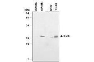Image no. 1 for anti-V-Ral Simian Leukemia Viral Oncogene Homolog B (Ras Related, GTP Binding Protein) (Ralb) antibody (ABIN204644) (RALB 抗体)
