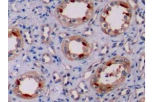Immunohistochemistry (IHC) image for anti-B-Cell CLL/lymphoma 2 (BCL2) (AA 2-211) antibody (ABIN7432577)