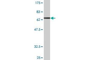 Western Blot detection against Immunogen (70. (Gasdermin B 抗体  (AA 1-411))