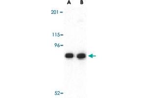Western blot analysis of CDH13 in NIH/3T3 lysate with CDH13 polyclonal antibody  at (A) 0. (Cadherin 13 抗体  (N-Term))