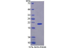 SDS-PAGE analysis of Rat PYGL Protein. (PYGL 蛋白)