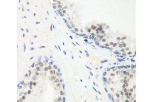 Immunohistochemistry of paraffin-embedded Human prostate using PPAN Polyclonal Antibody at dilution of 1:200 (40x lens). (PPAN 抗体)