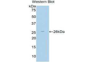 Western Blotting (WB) image for anti-Thyroid Peroxidase (TPO) (AA 19-846) antibody (ABIN1860847) (Thyroperoxidase 抗体  (AA 19-846))