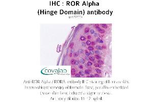 Image no. 2 for anti-RAR-Related Orphan Receptor A (RORA) antibody (ABIN1738922)