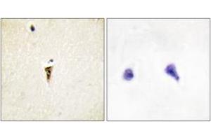 Immunohistochemistry (IHC) image for anti-Intestinal Cell (MAK-Like) Kinase (ICK) (AA 241-290) antibody (ABIN2889811) (ICK 抗体  (AA 241-290))