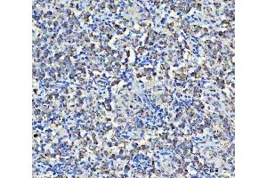 IHC analysis of Asparagine synthetase/ASNS using anti-Asparagine synthetase/ASNS antibody (ABIN7599465).