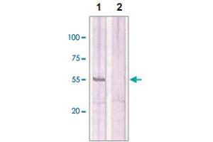 The whole cell lysates derived from MCF-7 were immunoblotted by ESR2 polyclonal antibody  at 1 : 500 (Lane 1). (ESR2 抗体  (C-Term))