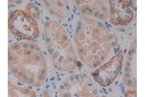 Detection of VSNL1 in Human Kidney Tissue using Polyclonal Antibody to Visinin Like Protein 1 (VSNL1) (VSNL1 抗体  (AA 39-184))