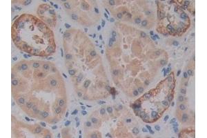 Detection of VSNL1 in Human Kidney Tissue using Polyclonal Antibody to Visinin Like Protein 1 (VSNL1) (VSNL1 抗体  (AA 39-184))