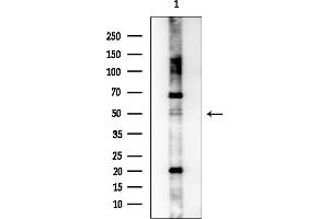 anti-Prostaglandin D2 Receptor (PTGDR) (Internal Region) antibody