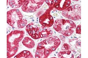 Immunohistochemistry (IHC) image for anti-Interleukin 23, alpha subunit p19 (IL23A) (C-Term) antibody (ABIN213941)