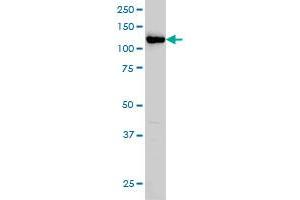 HIP1 monoclonal antibody (M01), clone 1F12 Western Blot analysis of HIP1 expression in HeLa . (HIP1 抗体  (AA 928-1037))