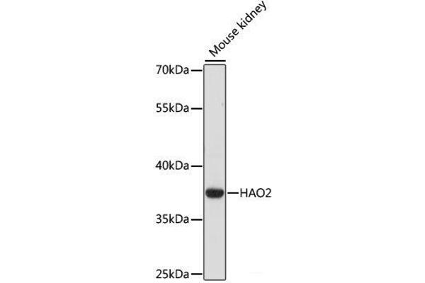 Hydroxyacid Oxidase 2 (HAO2) 抗体