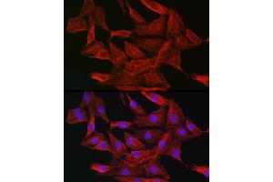Immunofluorescence analysis of NIH-3T3 cells using Gelsolin Rabbit pAb (ABIN7267365) at dilution of 1:50 (40x lens). (Gelsolin 抗体  (AA 543-782))