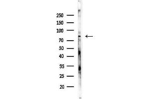 Western blot analysis of lysates from COLO205 cells(heat-shock,45 min treatment), using USP1 Antibody at 1/1000 dilution.