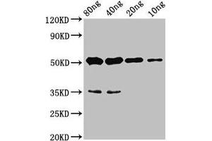 Western Blot Positive WB detected in Recombinant protein All lanes: cyp26b1 antibody at 4. (CYP26B1 抗体  (AA 366-511))