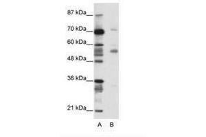 Image no. 1 for anti-Coronin, Actin Binding Protein, 1A (CORO1A) (N-Term) antibody (ABIN202574) (Coronin 1a 抗体  (N-Term))