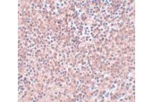 Immunohistochemistry (IHC) image for anti-Nanog Homeobox (NANOG) (Middle Region) antibody (ABIN1031009) (Nanog 抗体  (Middle Region))