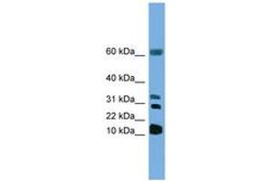 Image no. 1 for anti-Leukotriene C4 Synthase (LTC4S) (N-Term) antibody (ABIN6746296) (LTC4S 抗体  (N-Term))