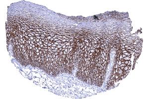 Esophagus squamous epithelium In the esophagus a strong membranous Dsg3 immunostaining predominantly occurs in the lower 2_3 of the squamous epithelium (Desmoglein 3 抗体  (AA 379-491))