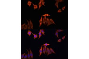 Immunofluorescence analysis of HeLa cells using KRAS antibody (ABIN3021676, ABIN3021677, ABIN3021678, ABIN1513137 and ABIN1514282) at dilution of 1:100. (K-RAS 抗体)