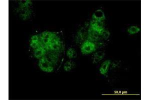 Immunofluorescence of monoclonal antibody to MEF2A on MCF-7 cell. (MEF2A 抗体  (AA 71-170))