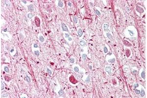 Anti-Androgen Receptor antibody IHC staining of human brain, cortex. (Androgen Receptor 抗体  (AA 621-670))