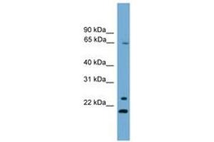 Image no. 1 for anti-Zinc Finger Protein 37A (ZNF37A) (AA 331-380) antibody (ABIN6745538) (ZNF37A 抗体  (AA 331-380))
