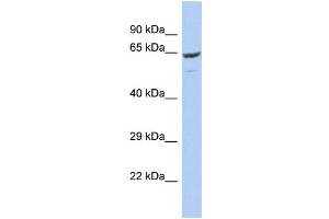 Host: Rabbit Target Name: FBXO21 Sample Type: OVCAR-3 Whole Cell lysates Antibody Dilution: 1. (FBXO21 抗体  (C-Term))