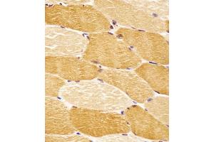 (ABIN6243301 and ABIN6578652) staining SLC29A2 in human skeletal muscle tissue sections by Immunohistochemistry (IHC-P - paraformaldehyde-fixed, paraffin-embedded sections).
