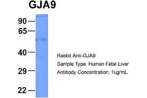 Host: Rabbit Target Name: GJA9 Sample Type: Human Fetal Liver Antibody Dilution: 1. (GJA9 抗体  (Middle Region))