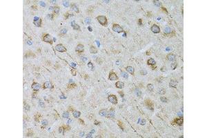 Immunohistochemistry of paraffin-embedded Rat brain using CRYM Polyclonal Antibody at dilution of 1:100 (40x lens). (CRYM 抗体)