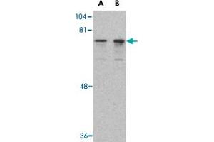 Western blot analysis of DDX3X in HepG2 cell lysate with DDX3X polyclonal antibody  at (A) 0.